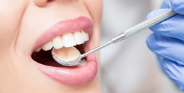 Teeth Cleaning in Dubai